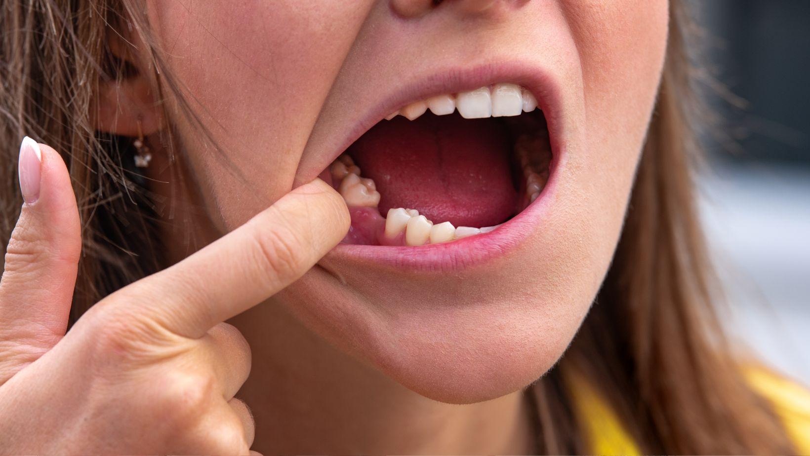 tooth extraction implant timing, dental implant healing stages, implant placement after extraction, post extraction implant timeline, dental implant recovery period, implant surgery after tooth removal, dental implant practical guidance, delayed implant placement, early vs delayed implant timing, best time for dental implant